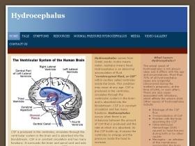 Hydrocephalus India