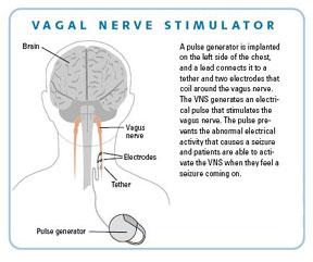 VNS.Dr.Sanjay Mongia