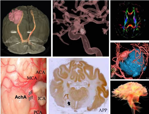 Neurosurgery