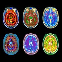 Neurosurgery